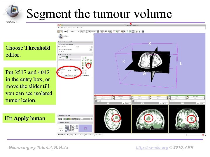 Segment the tumour volume Choose Threshold editor. Put 2517 and 4042 in the entry