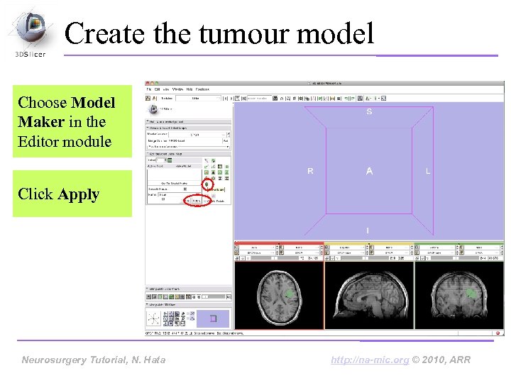 Create the tumour model Choose Model Maker in the Editor module Click Apply Neurosurgery