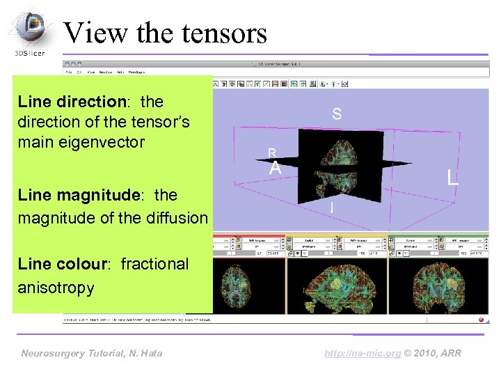 View the tensors Line direction: the direction of the tensor’s main eigenvector Line magnitude: