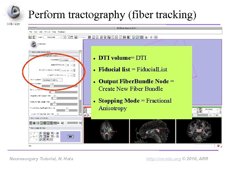 Perform tractography (fiber tracking) DTI volume= DTI Fiducial list = Fiducial. List Neurosurgery Tutorial,