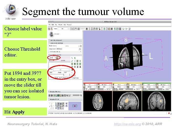 Segment the tumour volume Choose label value “ 2” Choose Threshold editor. Put 1894