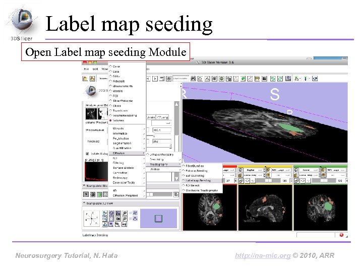 Label map seeding Open Label map seeding Module Neurosurgery Tutorial, Hata Neurosurgery Tutorial, N.
