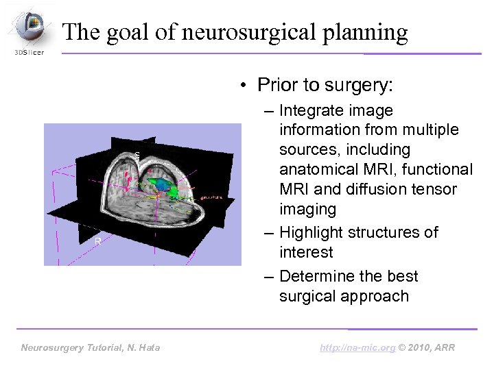 The goal of neurosurgical planning • Prior to surgery: – Integrate image information from