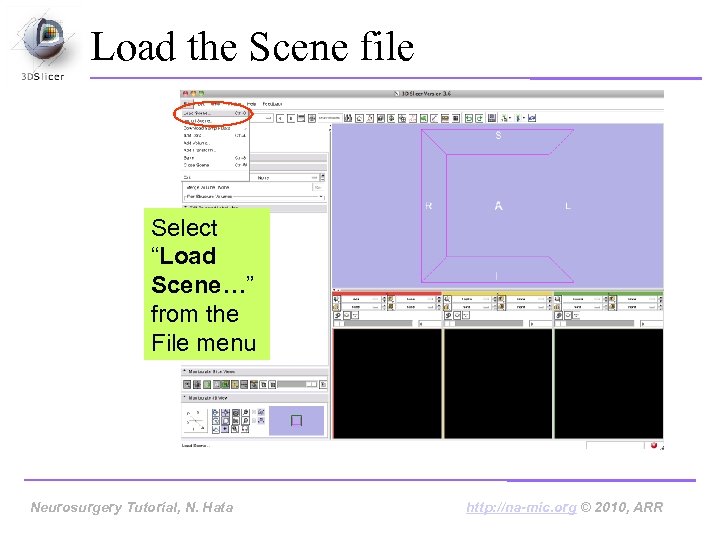 Load the Scene file Select “Load Scene…” from the File menu Neurosurgery Tutorial, N.