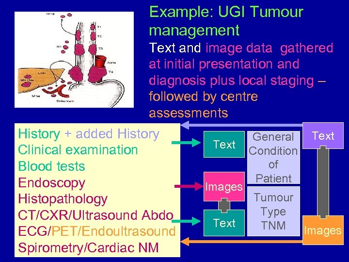 Example: UGI Tumour management Text and image data gathered at initial presentation and diagnosis