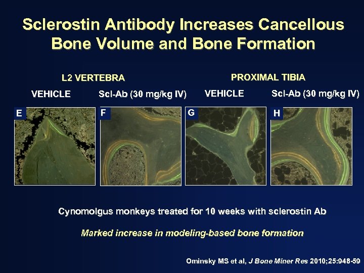 Sclerostin Antibody Increases Cancellous Bone Volume and Bone Formation PROXIMAL TIBIA L 2 VERTEBRA