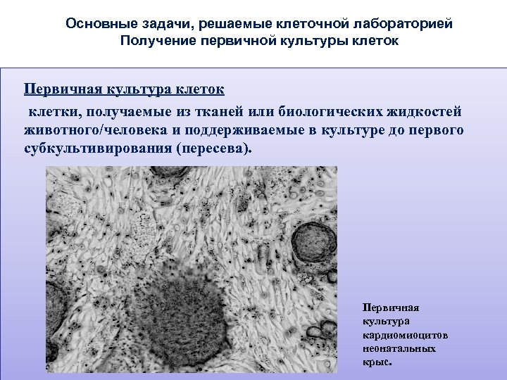 Задачи клетки. Первичные культуры клеток. Первичные культуры клеток животных. Однослойные культуры клеток. Получение первичной культуры клеток.