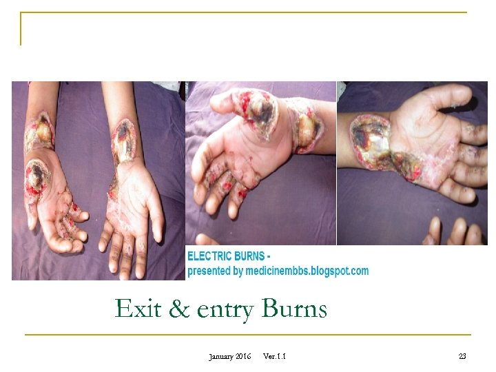 Exit & entry Burns January 2016 Ver. 1. 1 23 
