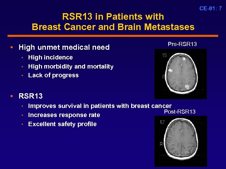 RSR 13 in Patients with Breast Cancer and Brain Metastases § High unmet medical