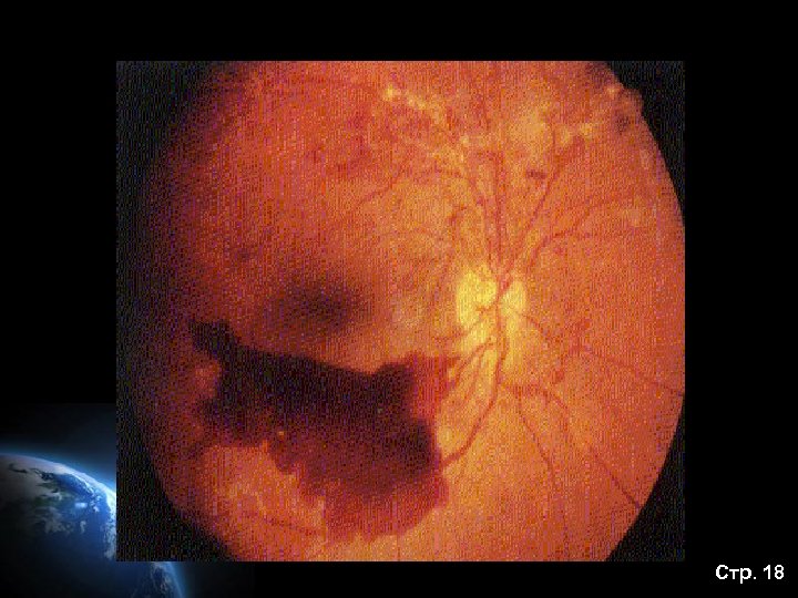 Стр. 18 