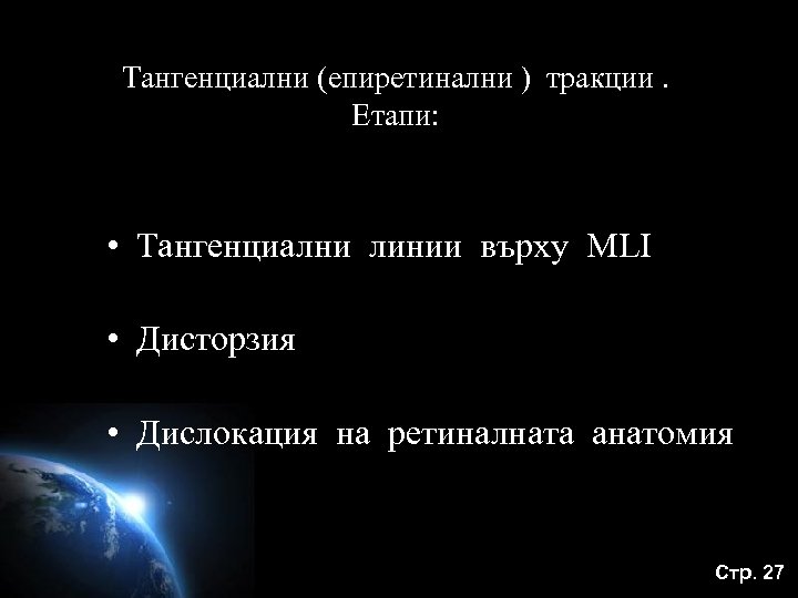 Тангенциални (епиретинални ) тракции. Етапи: • Тангенциални линии върху MLI • Дисторзия • Дислокация