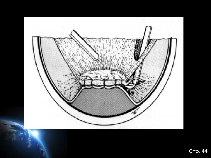 Стр. 44 