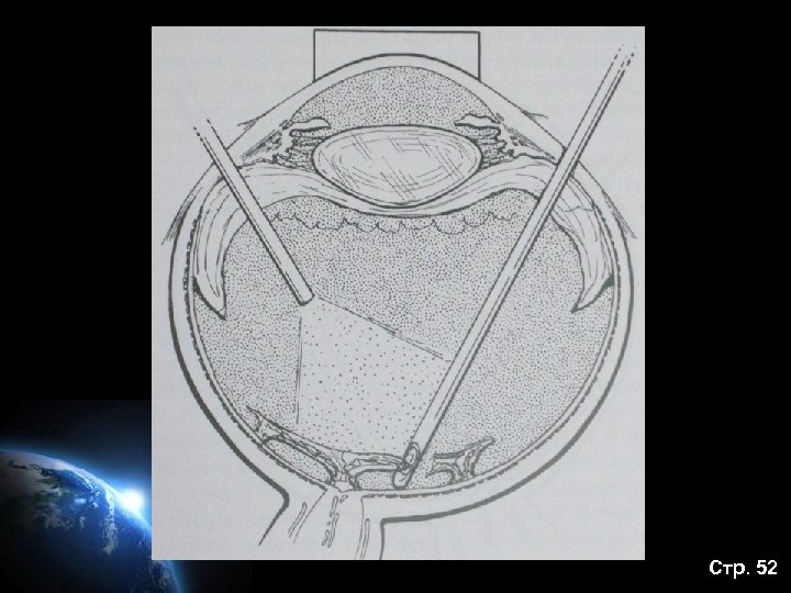 Стр. 52 