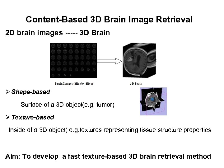 Content-Based 3 D Brain Image Retrieval 2 D brain images ----- 3 D Brain