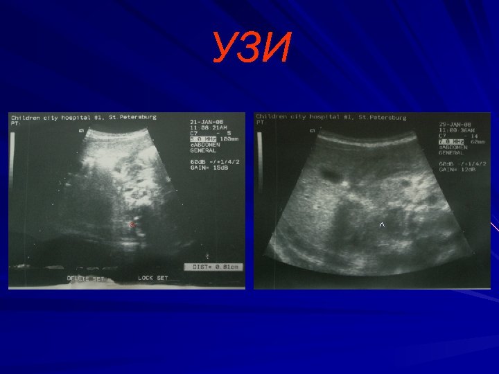 УЗИ ^ ^ 