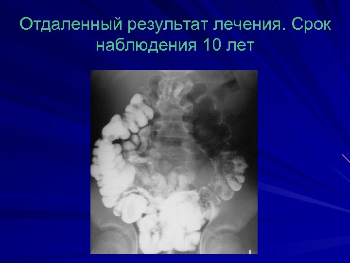 Отдаленный результат лечения. Срок наблюдения 10 лет 
