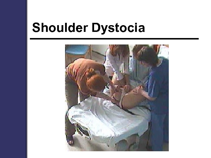 Shoulder Dystocia 