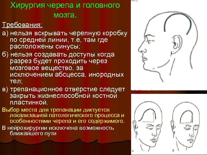 Хирургия черепа и головного мозга. Требования: а) нельзя вскрывать черепную коробку по средней линии,