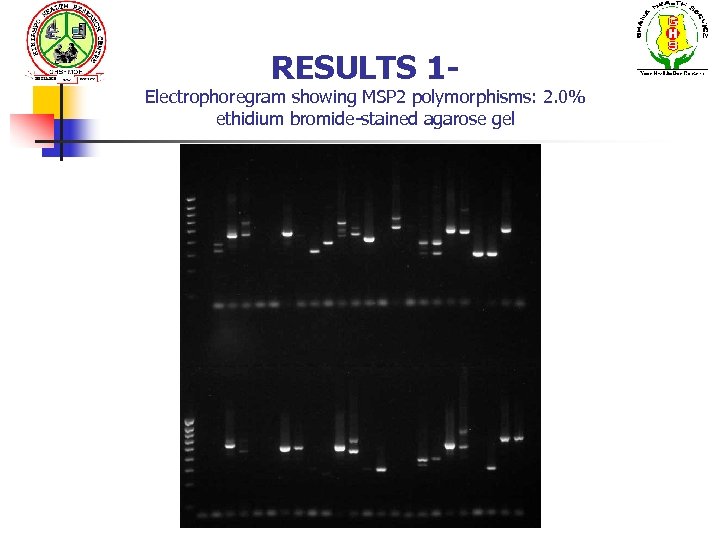 RESULTS 1 - Electrophoregram showing MSP 2 polymorphisms: 2. 0% ethidium bromide-stained agarose gel