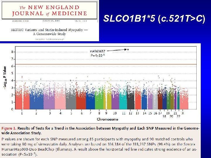 SLCO 1 B 1*5 (c. 521 T>C) 