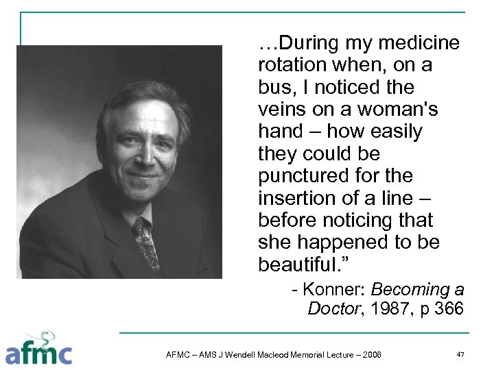 …During my medicine rotation when, on a bus, I noticed the veins on a