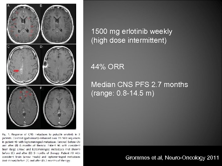 1500 mg erlotinib weekly (high dose intermittent) 44% ORR Median CNS PFS 2. 7