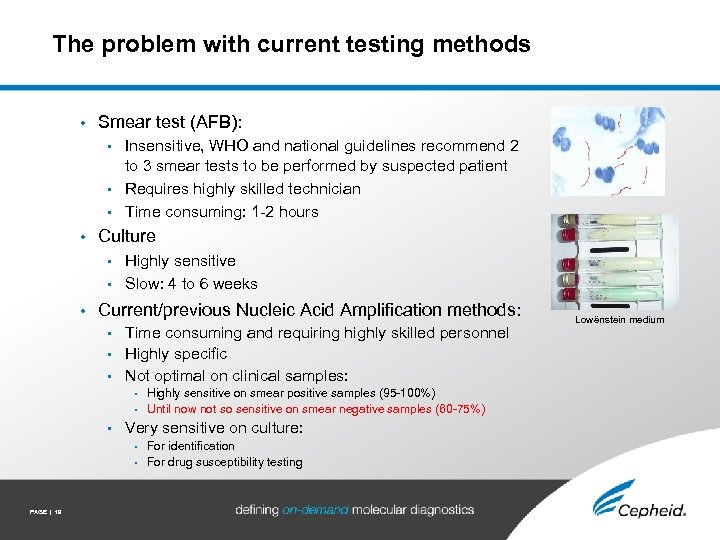 The problem with current testing methods • Smear test (AFB): Insensitive, WHO and national