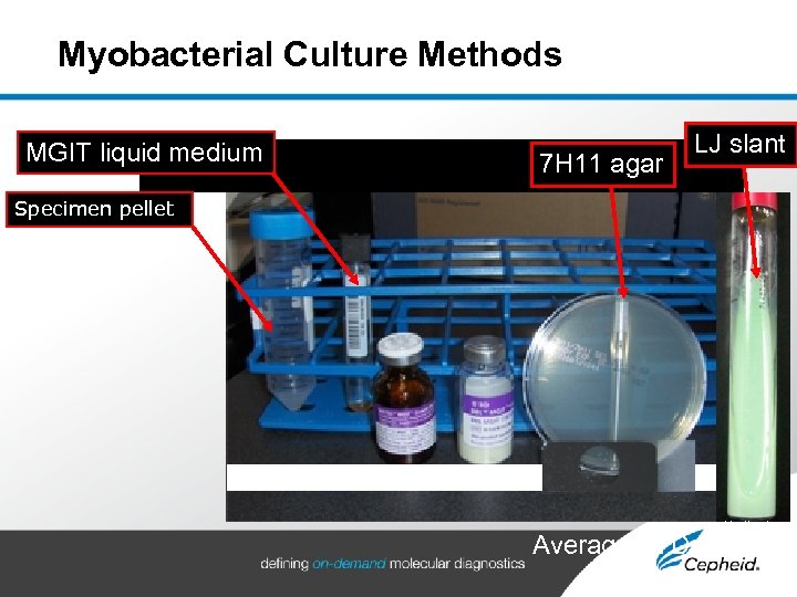Myobacterial Culture Methods MGIT liquid medium 7 H 11 agar LJ slant Specimen pellet