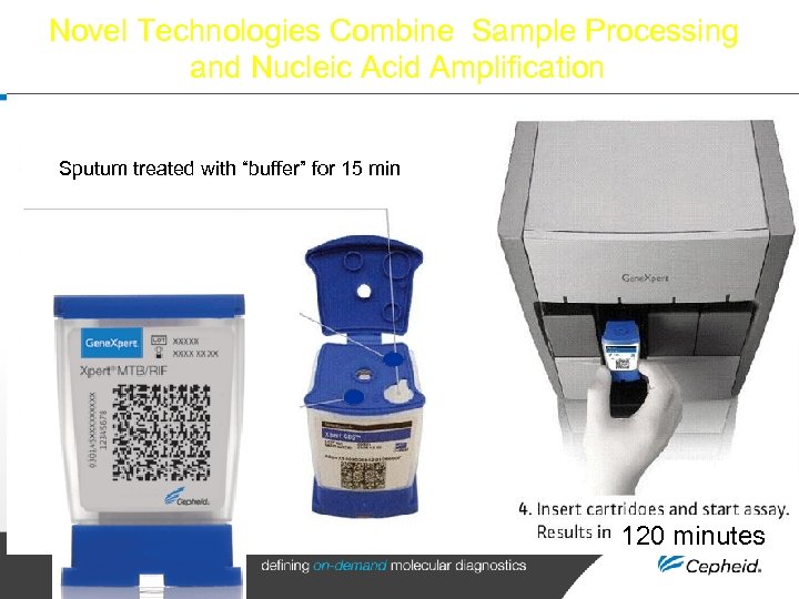 Novel Technologies Combine Sample Processing and Nucleic Acid Amplification Sputum treated with “buffer” for