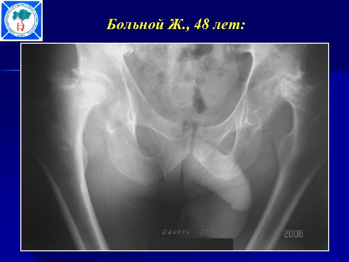 Больной Ж. , 48 лет: 