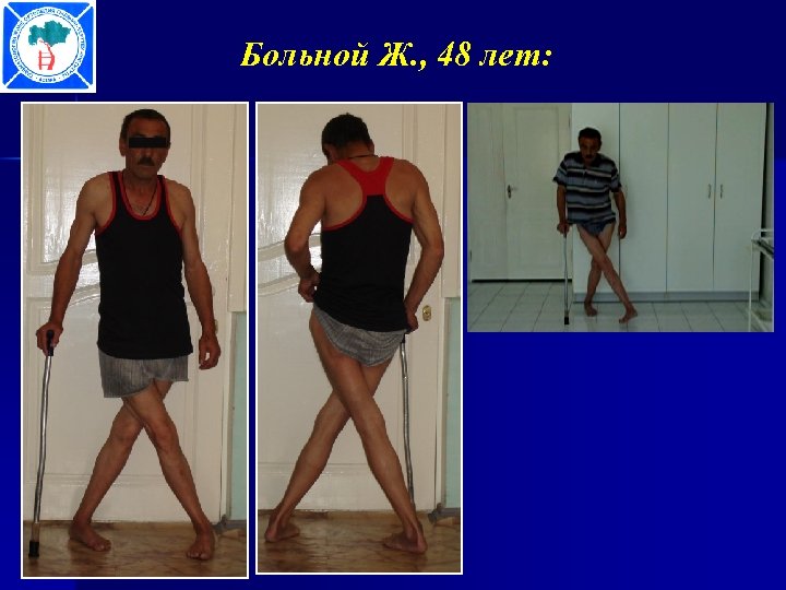 Больной Ж. , 48 лет: 