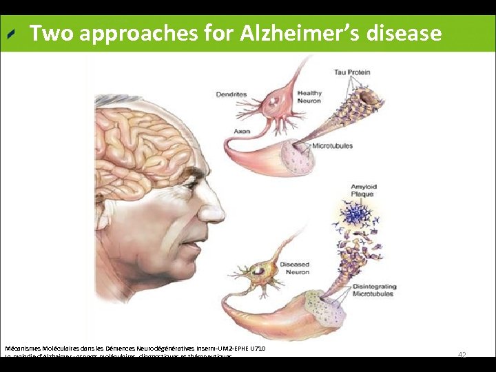 Two approaches for Alzheimer’s disease Mécanismes Moléculaires dans les Démences Neurodégénératives Inserm-UM 2 -EPHE