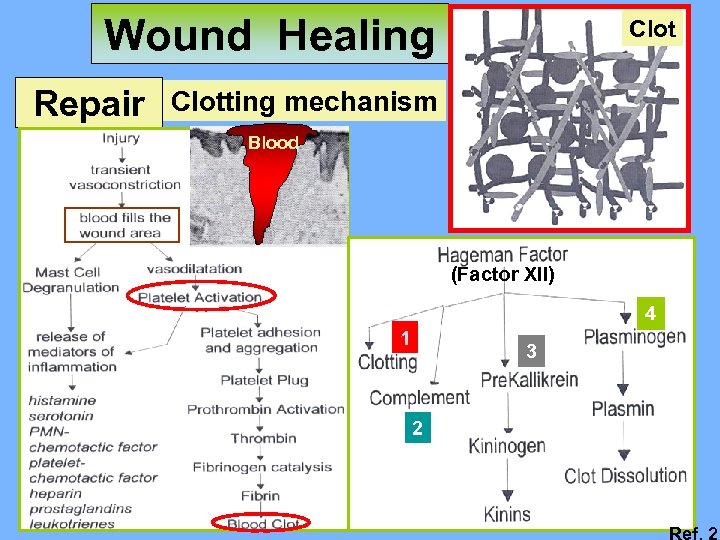 Wound Healing Repair Clotting mechanism Blood (Factor XII) 4 1 3 2 Ref. 2