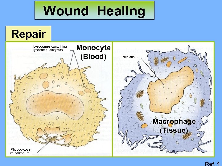 Wound Healing Repair Lysosomes containing lysosomal enzymes Monocyte (Blood) Nucleus Macrophage (Tissue) Phagocytosis of