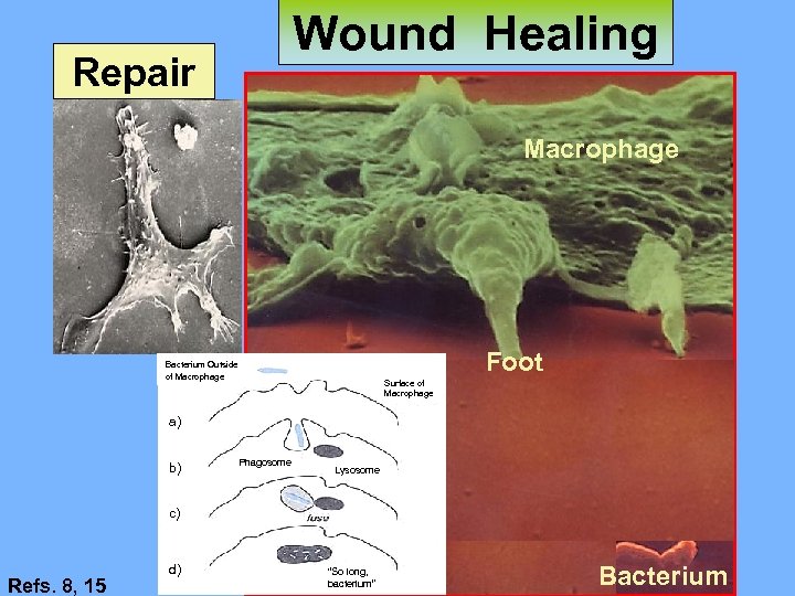 Wound Healing Repair Macrophage Foot Bacterium Outside of Macrophage Surface of Macrophage a) b)