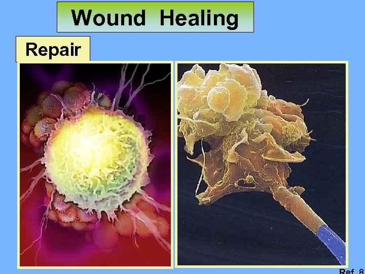 Wound Healing Repair 