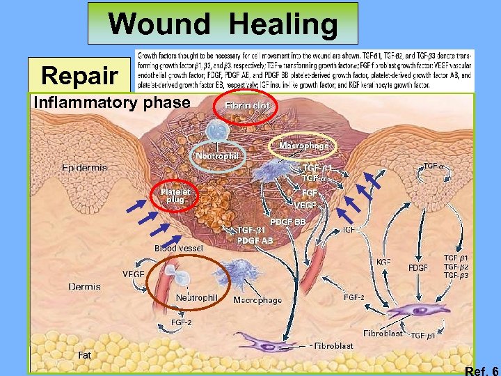 Wound Healing Repair Inflammatory phase Ref. 6 