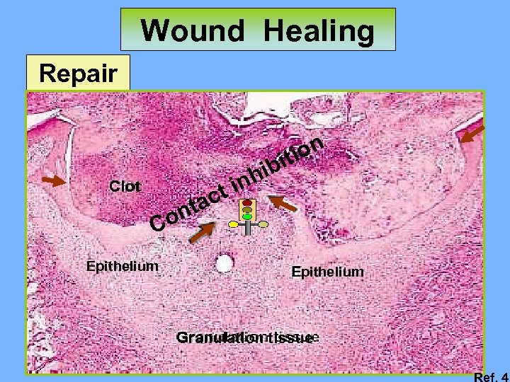 Wound Healing Repair ion it Clot ct ta hib in on C Epithelium Granulation