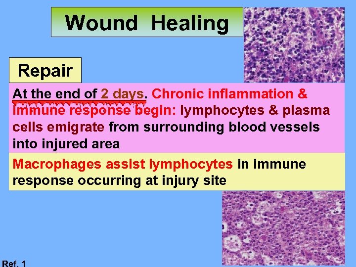 Wound Healing Repair At the end of 2 days. Chronic inflammation & immune response