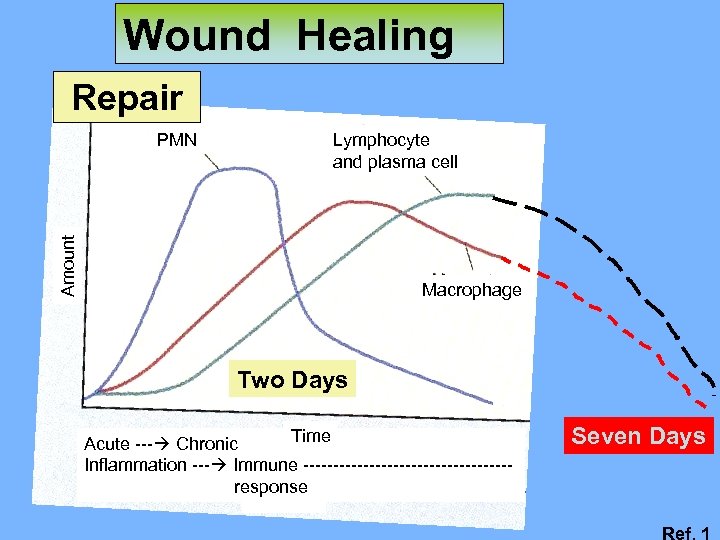 Wound Healing Repair Lymphocyte and plasma cell Amount PMN Macrophage Two Days Time Acute