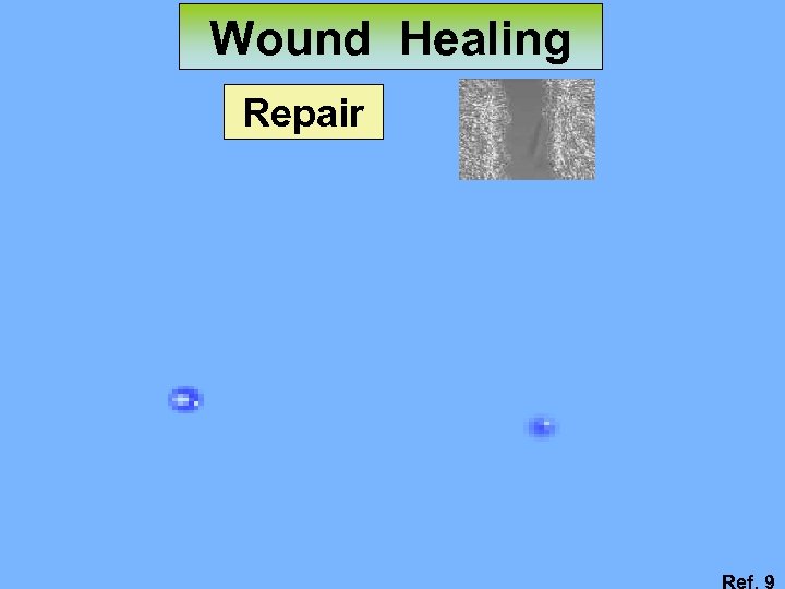 Wound Healing Repair Ref. 9 