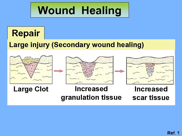 口腔病理科 Wound Healing 傷口癒合 陳玉昆教授 高雄醫學大學 口腔病理科 07