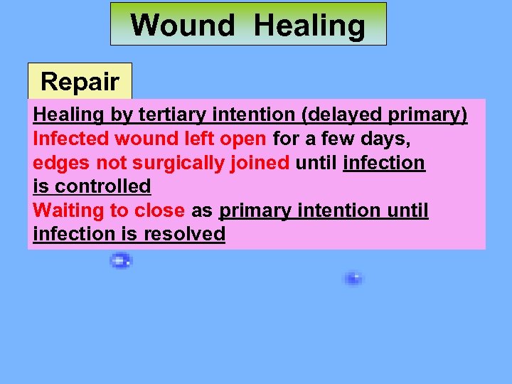 Wound Healing Repair Healing by tertiary intention (delayed primary) Infected wound left open for