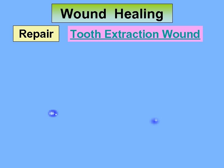 Wound Healing Repair Tooth Extraction Wound 