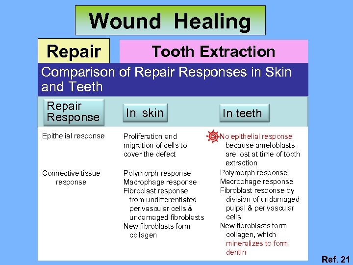 Wound Healing Repair Tooth Extraction Wound Comparison of Repair Responses in Skin and Teeth