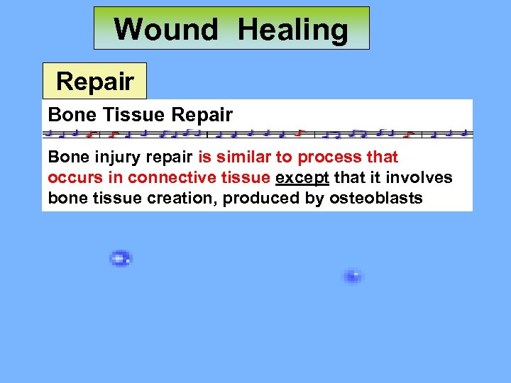 Wound Healing Repair Bone Tissue Repair Bone injury repair is similar to process that