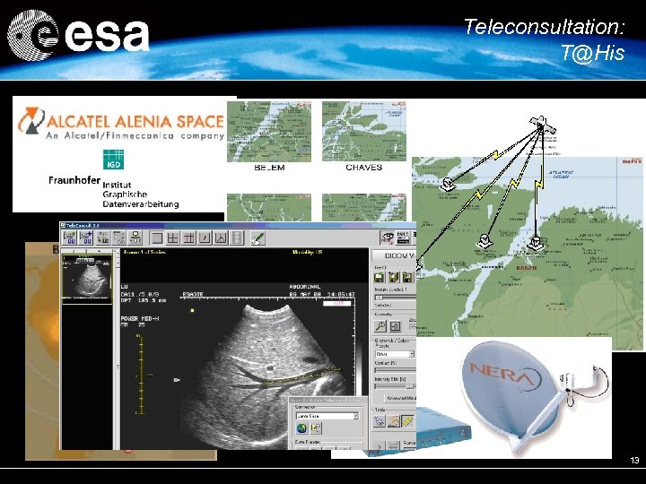 Teleconsultation: T@His 13 