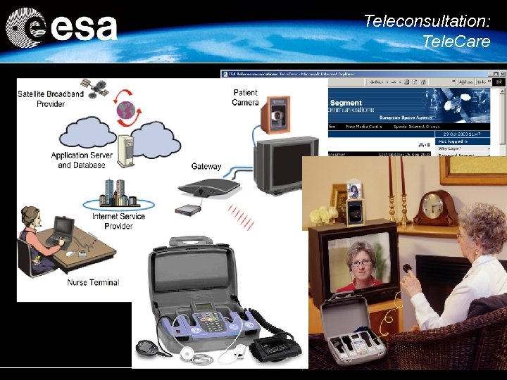 Teleconsultation: Tele. Care 15 