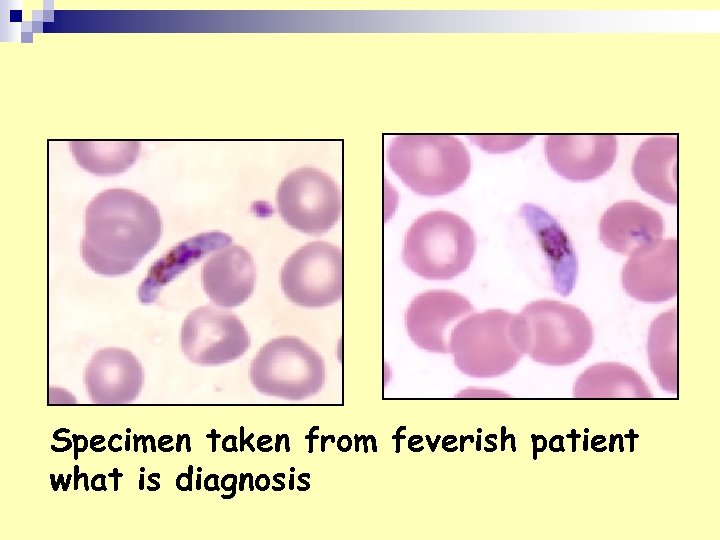 Specimen taken from feverish patient what is diagnosis 