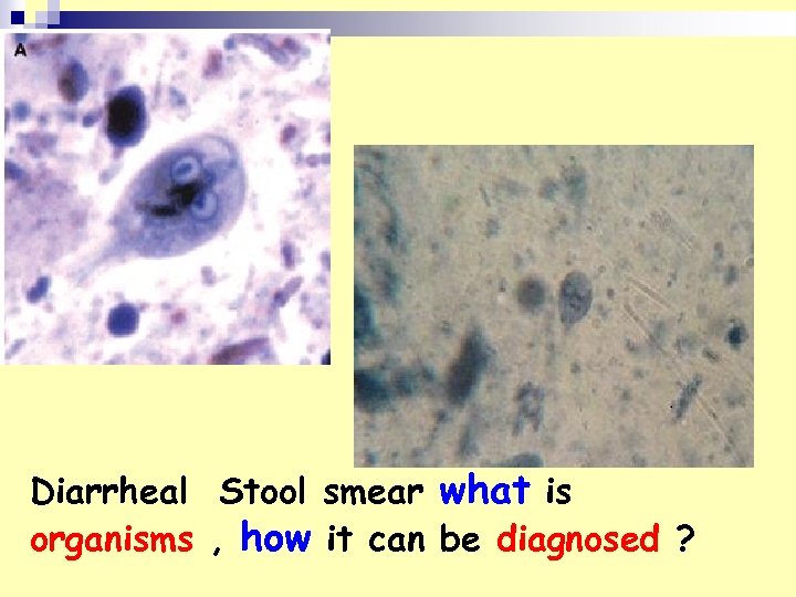 Diarrheal Stool smear what is organisms , how it can be diagnosed ? 